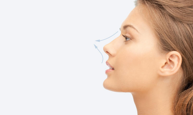 ボトックス（アップノーズ） botox-nose