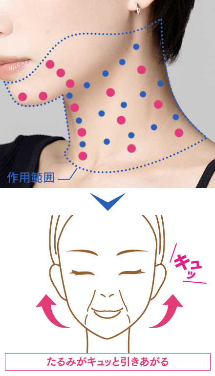 ボトックス 輪郭 ネックシェイプ 公式 オザキクリニック