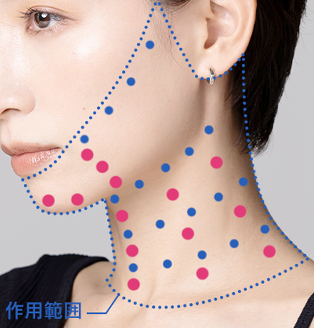 フェイス＆ネックリフトの注入ポイント
