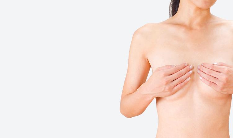乳房吊り上げ術（乳房固定術） breast-lift