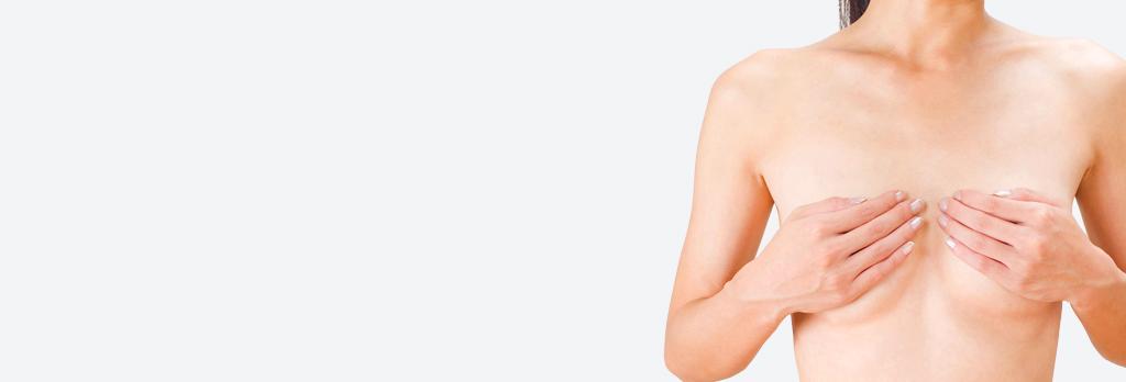 乳房吊り上げ術（乳房固定術） breast-lift
