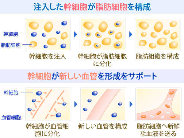 注入した幹細胞が脂肪細胞を構成、幹細胞が新しい血管の形成をサポート