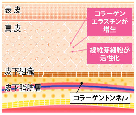 コラーゲン増産効果のイメージ