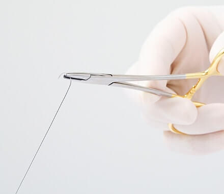 切除&縫合技術イメージ