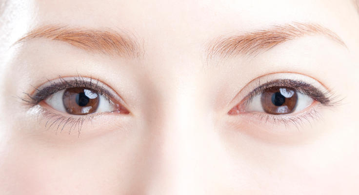 全切開二重まぶた法