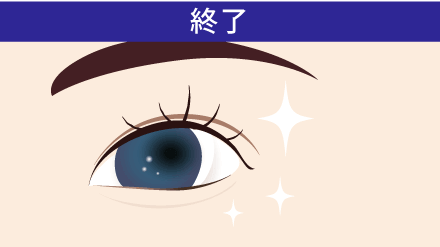 目の下の脱脂の施術終了イメージ
