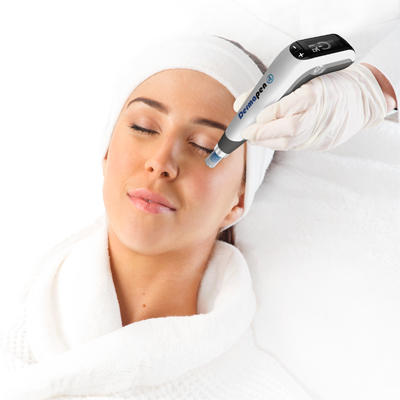 ダーマペン4の施術風景