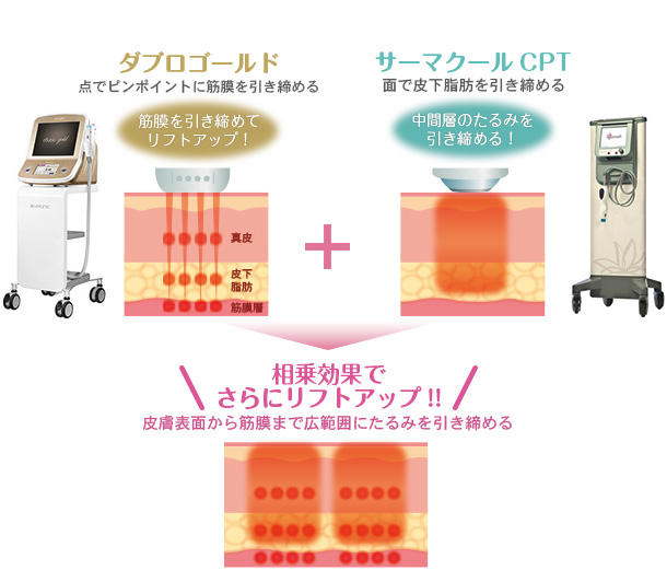 ダブロ ゴールドとサーマクールCPTの相乗効果でさらにリフトアップ！！皮膚表面から筋膜まで広範囲にたるみを引き締める