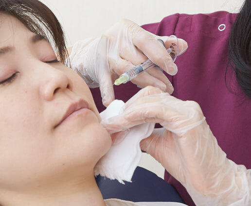 マーキング、注入治療