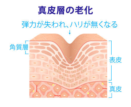 真皮層の老化