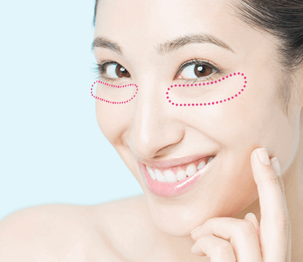 筋膜アイズリフトの適応症状