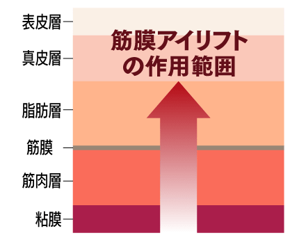 筋膜アイリフトの作用範囲