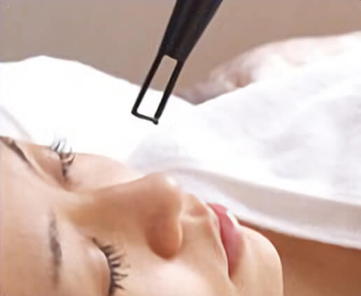 『QスイッチYAGレーザー』照射