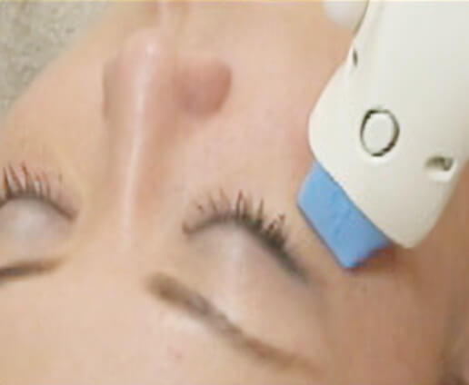 『アイズバイサメイジ』照射