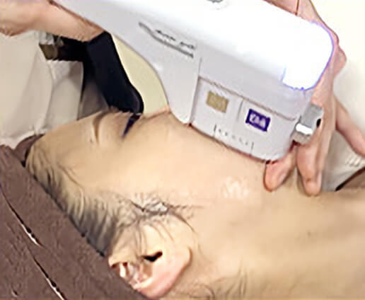 『ダブロ ゴールド』照射