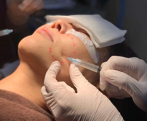 真皮線維芽細胞移植