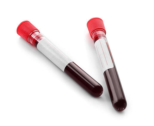 インキュベーション・血清の抽出