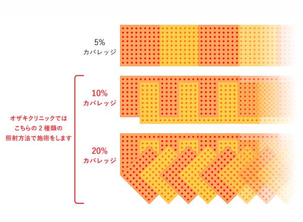 臨床光皮膚科学 皮膚科向け紫外線治療器シリーズの最新機種「セラビーム® UVA1