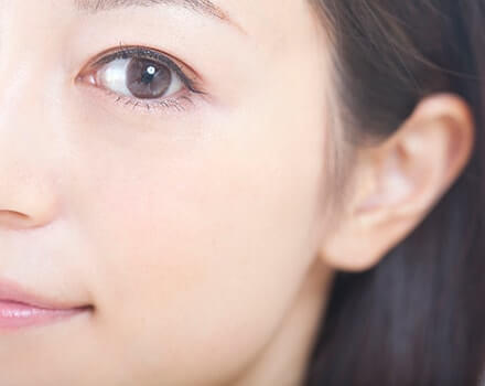 目尻切開と二重埋没法のセット治療のイメージ