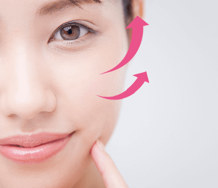 ハムラ法（目の下のたるみ取り）のイメージ