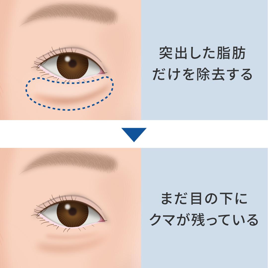 脱脂だけでは改善しない理由