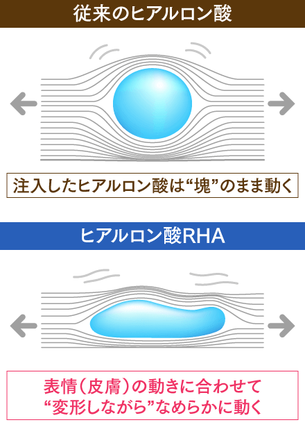 しなやかで動きになじむヒアルロン酸RHAの説明
