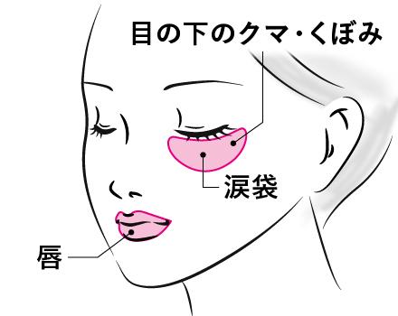 ボルベラ(ヴォルベラ)の適応部位