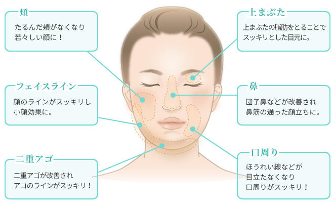 脂肪溶解注射カベリン 顔やせ 公式 オザキクリニック