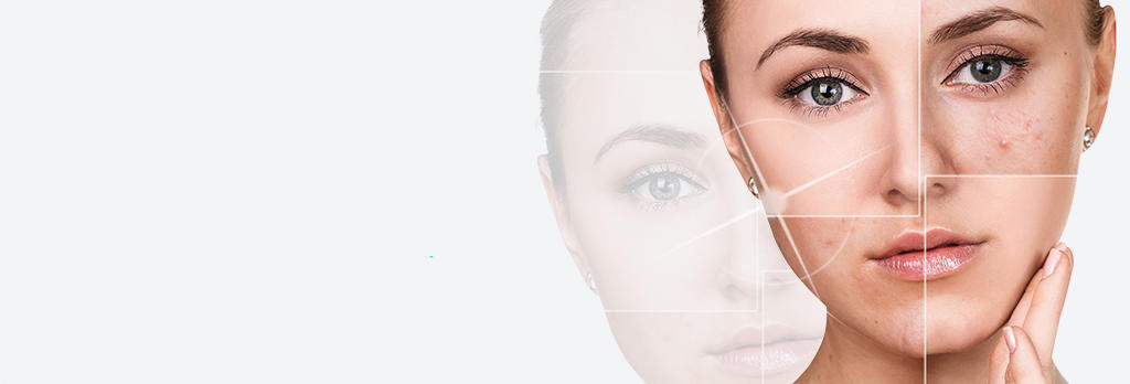 小林式ニキビ治療法 kobayashi-acne