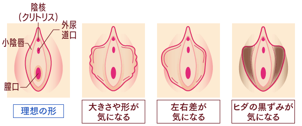 症例 しょう 写真 いん しん 切除