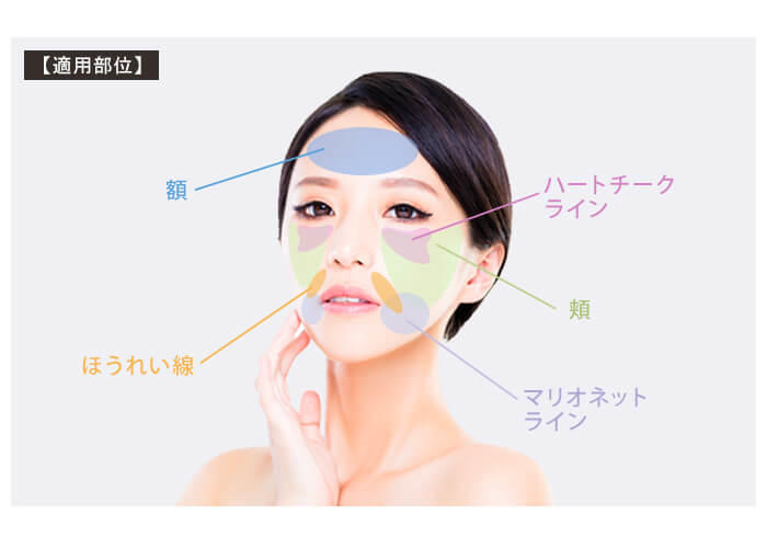 肌再生高純度脂肪注入の適用部位のイメージ
