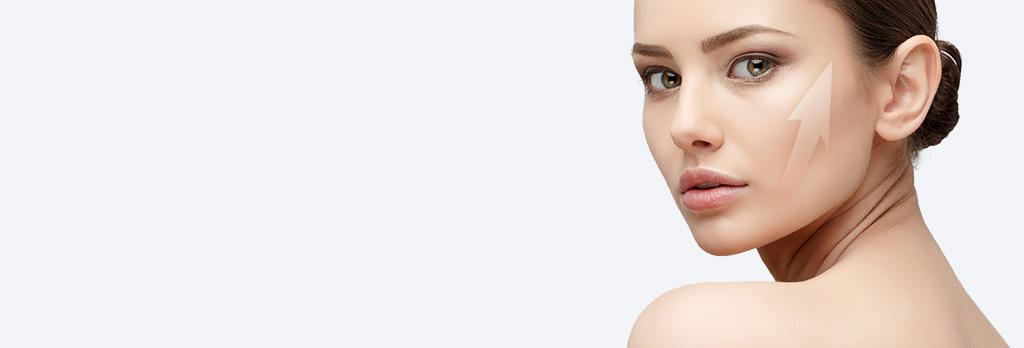 ミッドフェイスリフト midface-lift-single