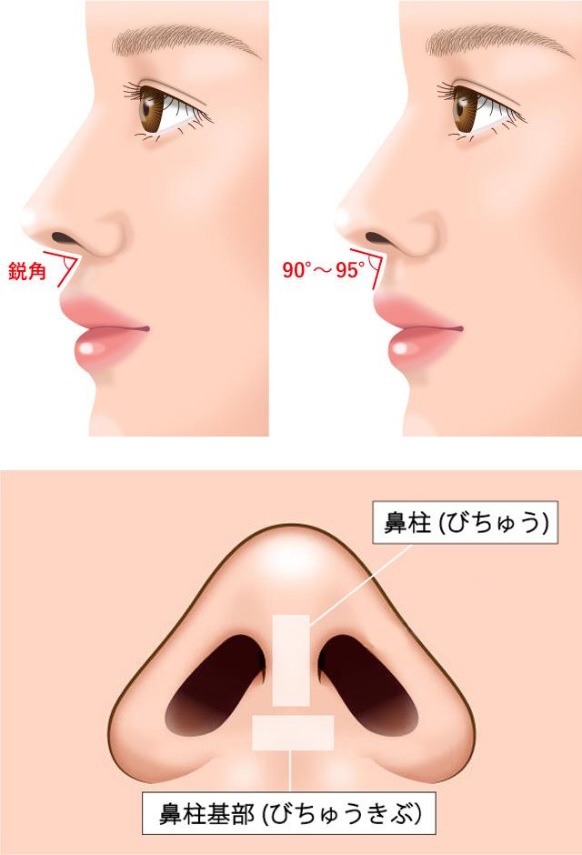 鼻形成術 猫手術（鼻唇角形成術）｜【公式】オザキクリニック（新宿・目黒