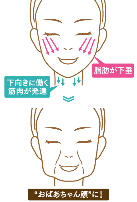 ブルドック顔のイメージ