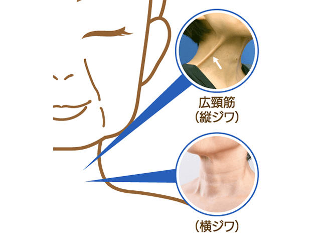 首のシワやたるみの原因