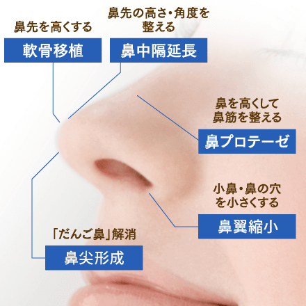 鼻の施術のイメージ