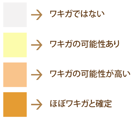 耳垢 ワキガ 実はワキガは女性の方が多いのです！