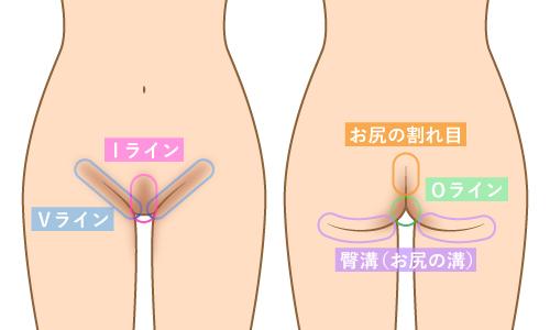 デリケートゾーンの黒ずみはクリニックで解消『ピンクインティメイト 買い公式 ピンクインティメント 4本 その他