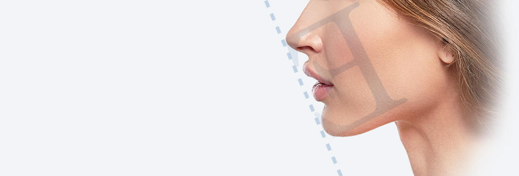 アゴプロテーゼ（アゴ整形） prothese