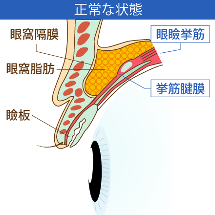 眼瞼下垂の正常な状態のイメージ