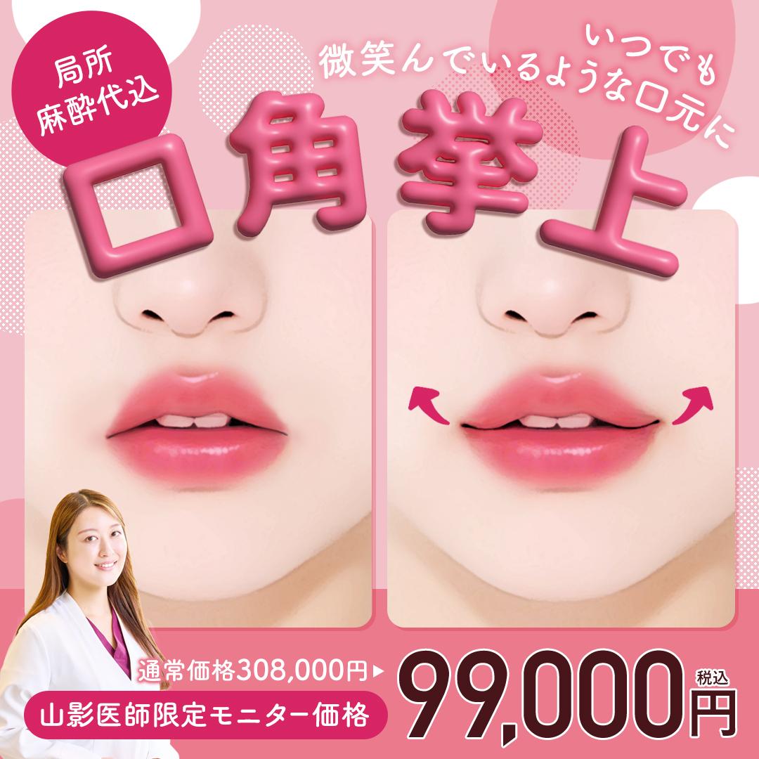 口角挙上モニター