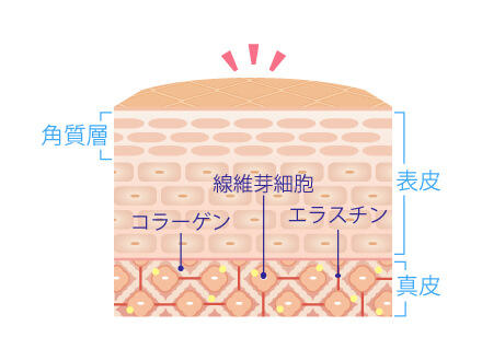 サリチル酸マクロゴールピーリング肌断層