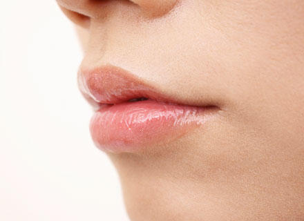 口角挙上（スマイルリップ）のイメージ