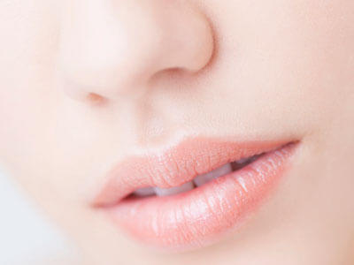 人中短縮（リップリフト）のイメージ