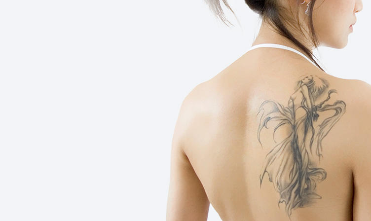 タトゥー除去（レーザー除去法） tatoo-laser