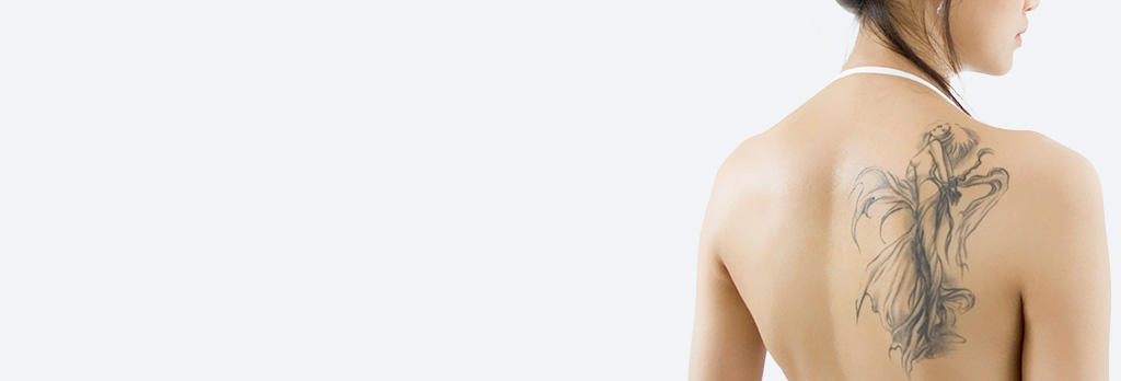 タトゥー除去（レーザー除去法） tatoo-laser