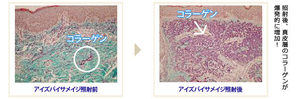 コラーゲン増産の様子