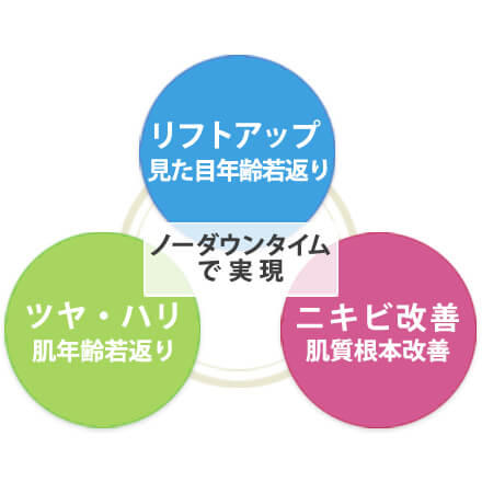 ノーダウンタイムで実現イメージ