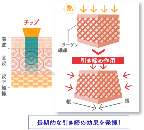 長期的な引き締め効果を発揮!