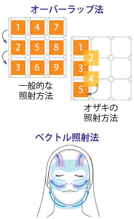 オーバーラップ法、ベクトル照射法のイメージ